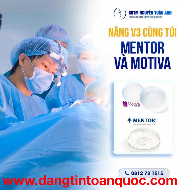 Túi Mentor và Motiva – Loại nào nâng cấp vòng 3 tốt nhất