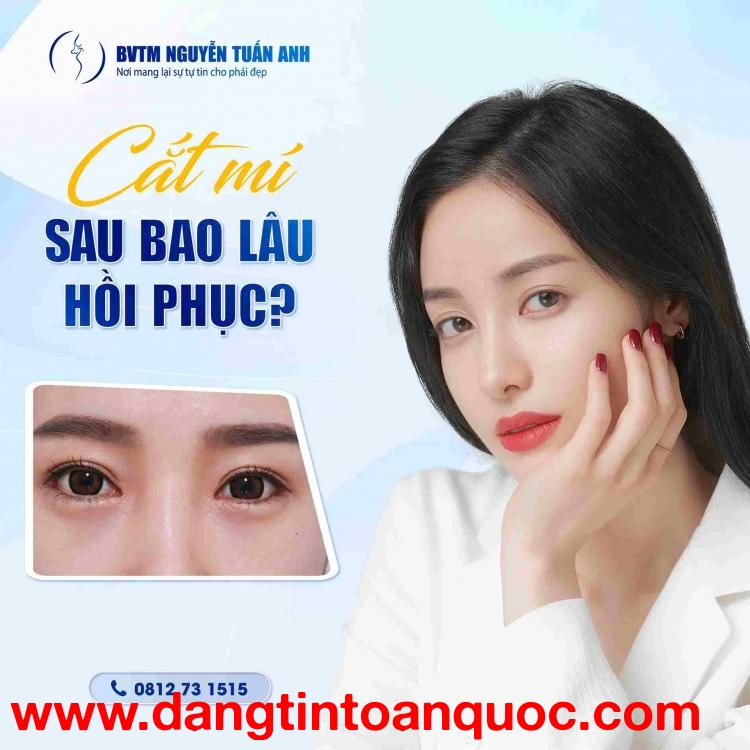 Lưu ý sau khi phẫu thuật thẩm mỹ mí mắt