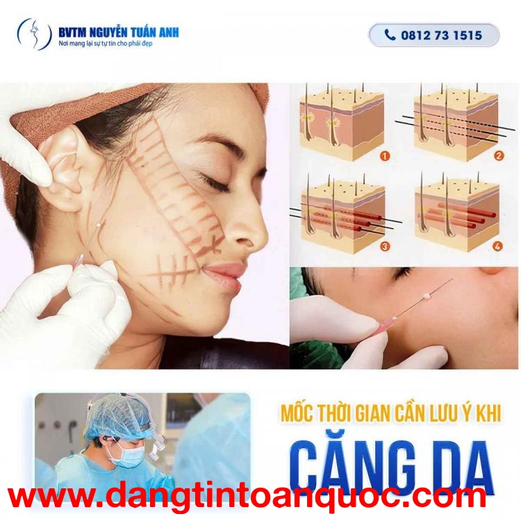 Thời gian hồi phục sau khi phẫu thuật thẩm mỹ căng da