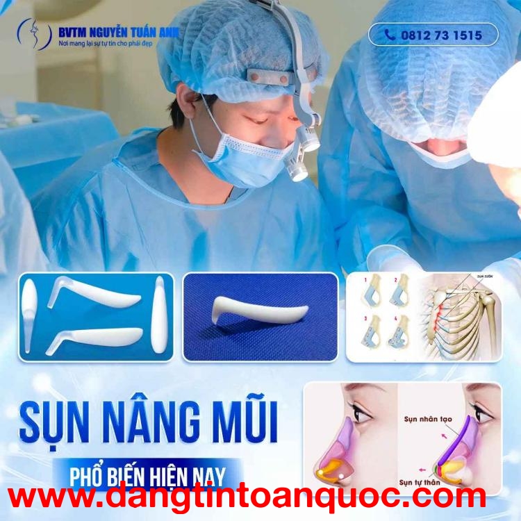 Những loại sụn nâng mũi phổ biến hiện nay