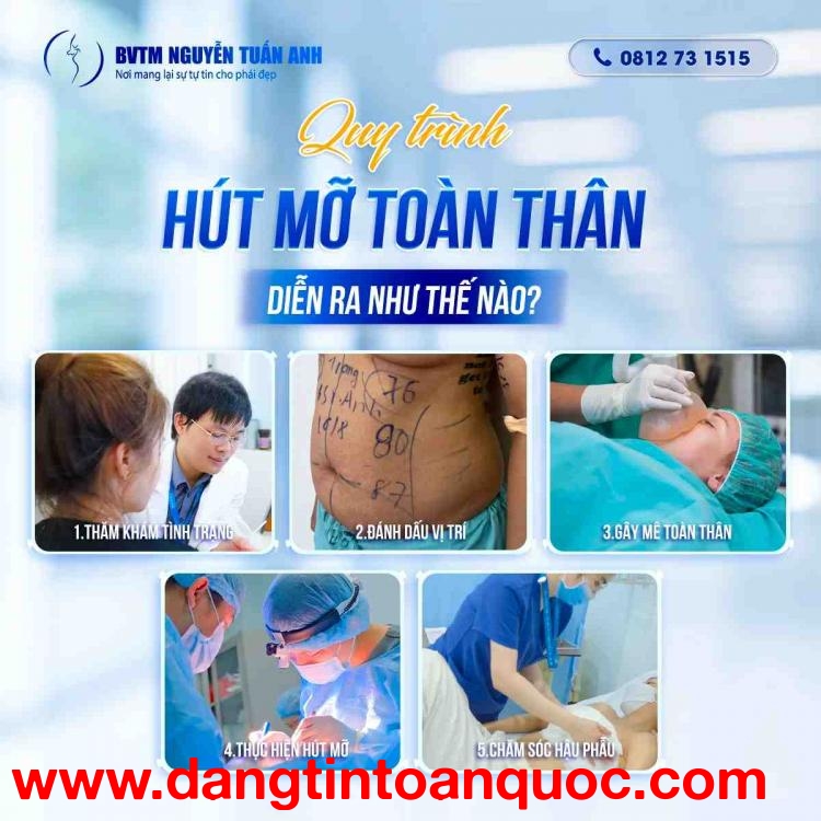 Quy trình hút mỡ toàn thân diễn ra như thế nào?