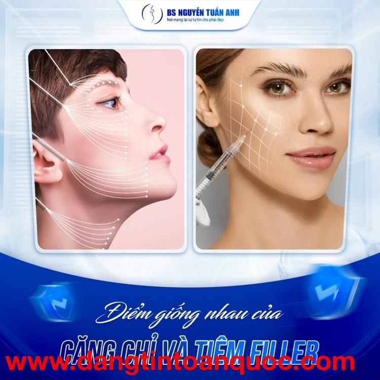 Tiêm Filler: An Toàn Hay Tiềm Ẩn Nguy Cơ