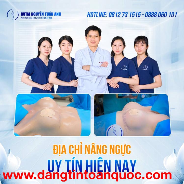 Nâng ngực túi độn là gì?