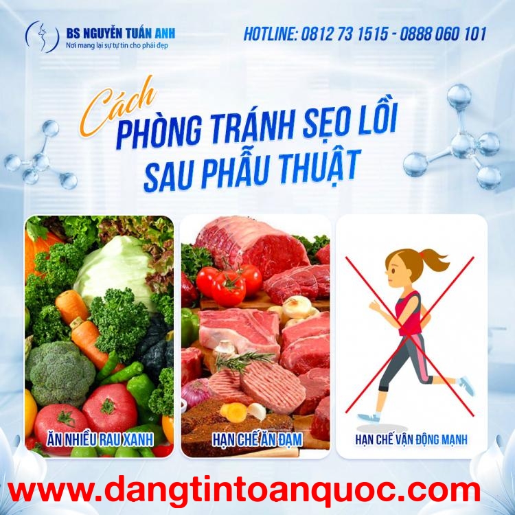 Cắt mí và treo cung mày có gì khác nhau