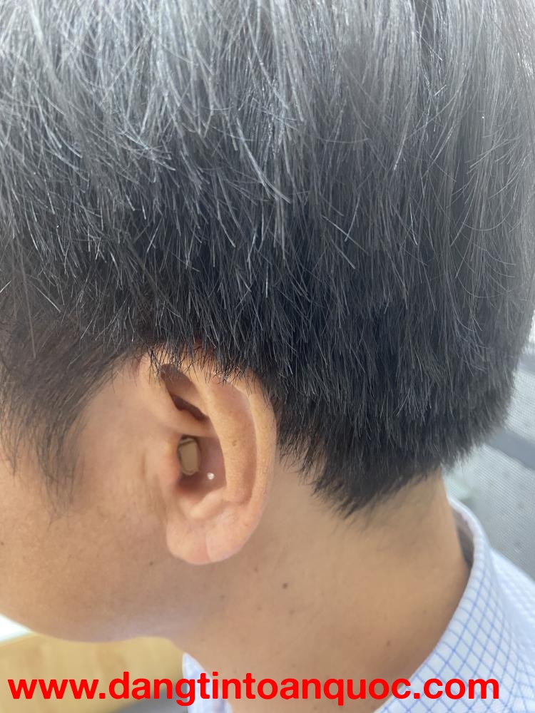 Máy trợ thính CIC - máy trợ thính trong tai