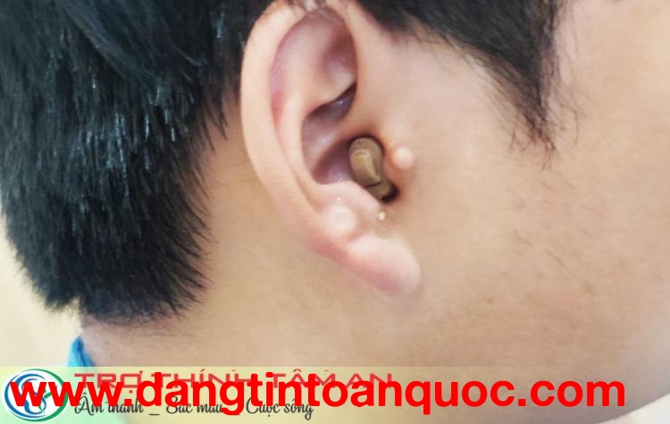 MÁY TRỢ THÍNH TRONG TAI CIC NHỎ GỌN THẨM MỸ