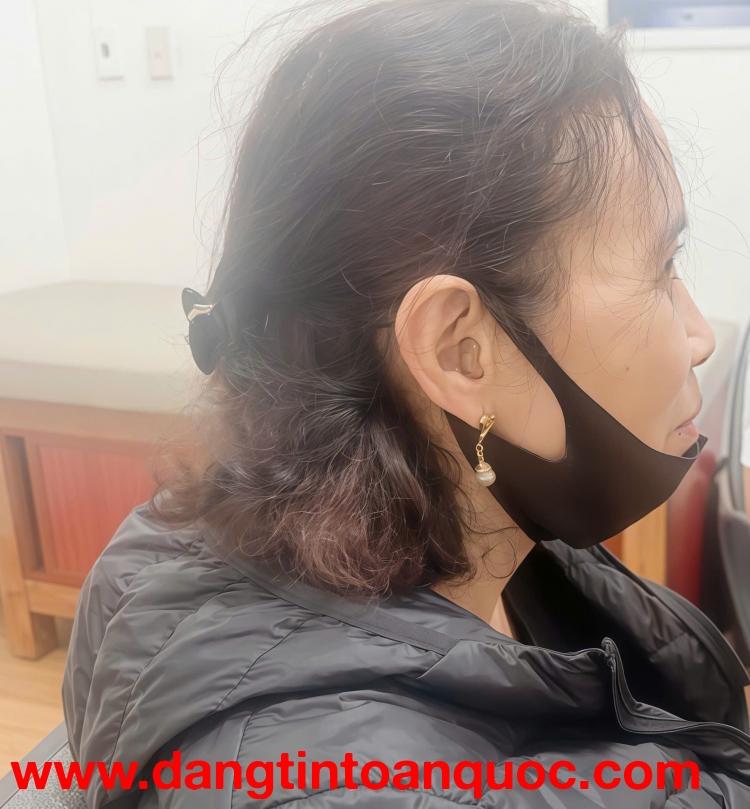 Máy trợ thính CIC IX